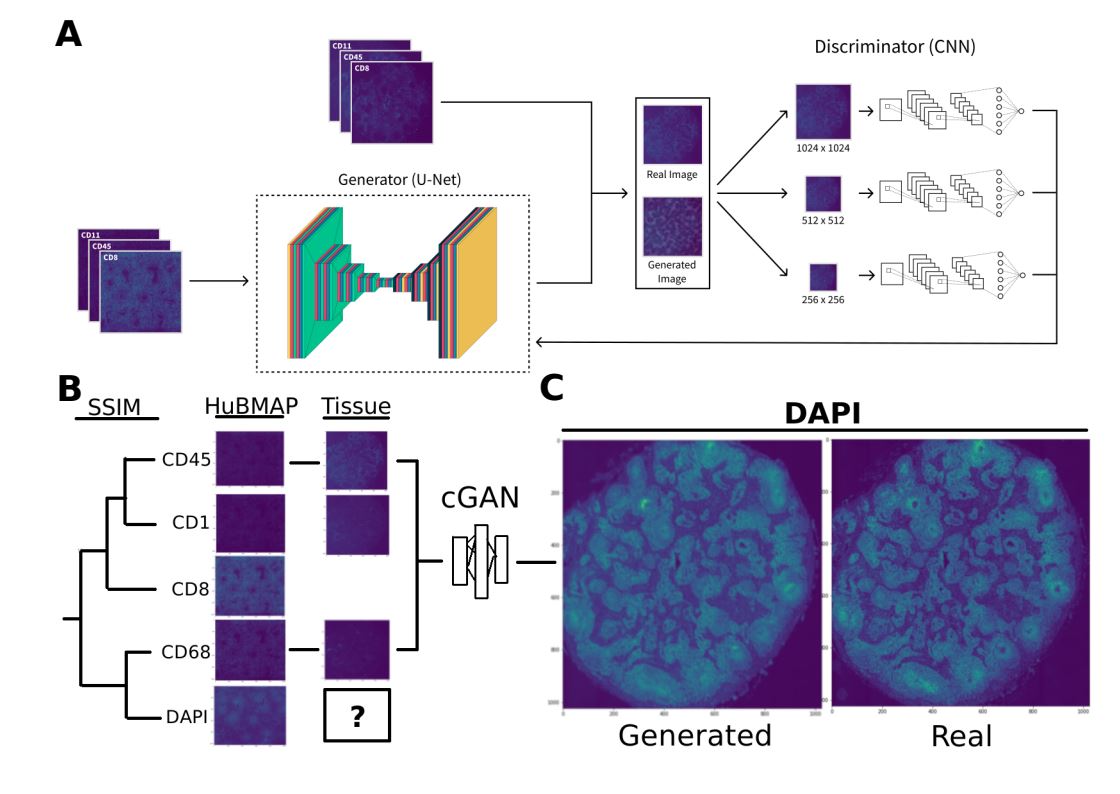 A SSIM Guided cGAN Architecture For Clinically Driven Generative Image Synthesis of Multiplexed Spatial Proteomics Channels