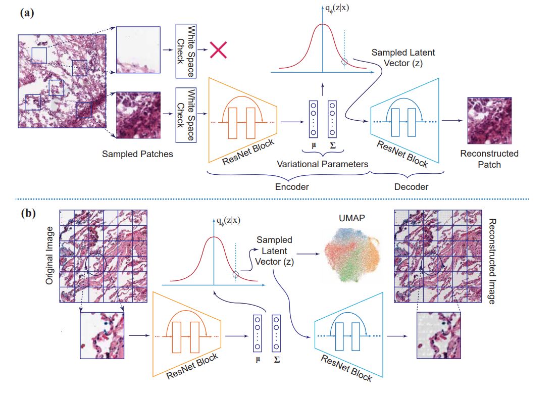Clinically Relevant Latent Space Embedding of Cancer Histopathology Slides through Variational Autoencoder Based Image Compression